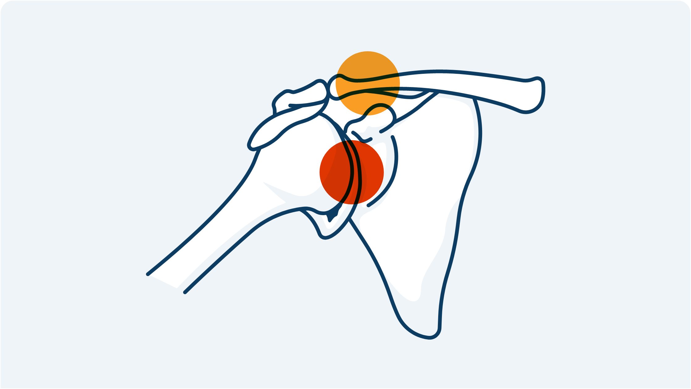Illustration of the humerus head & acromioclavicular joint.