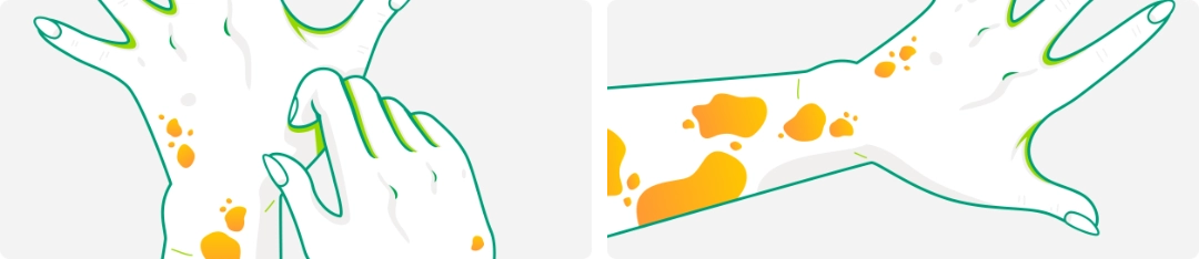 Illustrations of hands with rash and scratching to  represent itch, and hands and arms with raised  welts to represent hives (wheals).