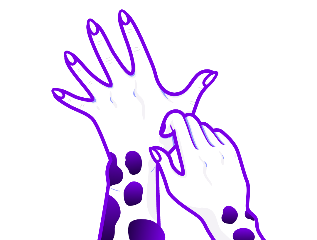 Illustration of a lichen simplex chronicus with thickened, itchy skin. 