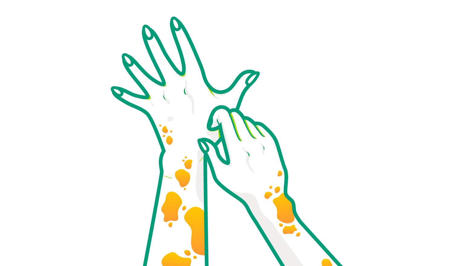 Illustration of two arms with hives