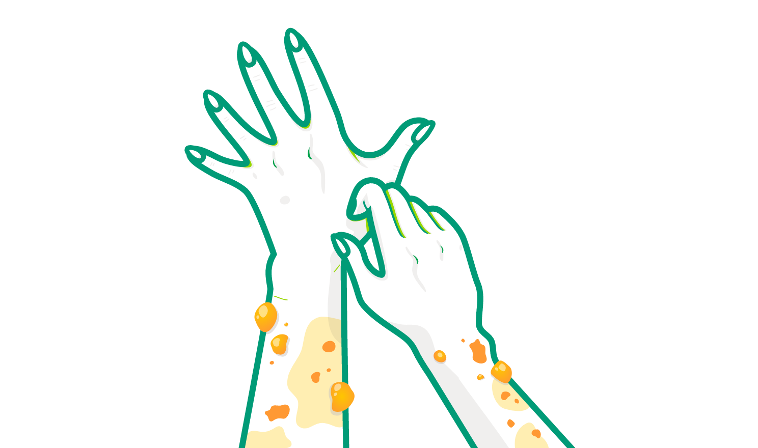 Illustration of two arms with rash and lesions.