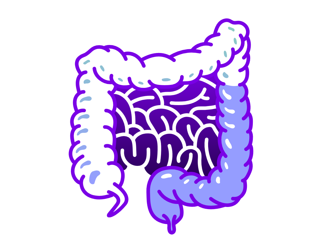 Illustration of digestive tract highlighting inflamed colon in ulcerative colitis. 
