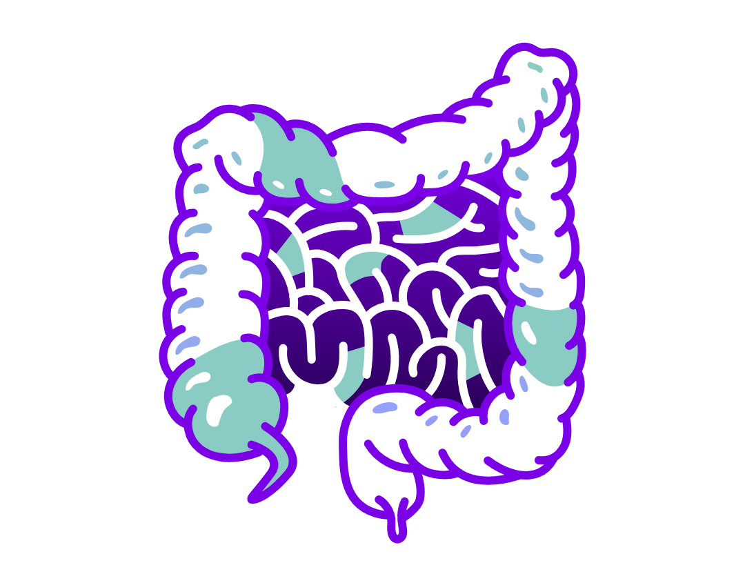 Illustration of intestinal showing celiac-related inflammation. 