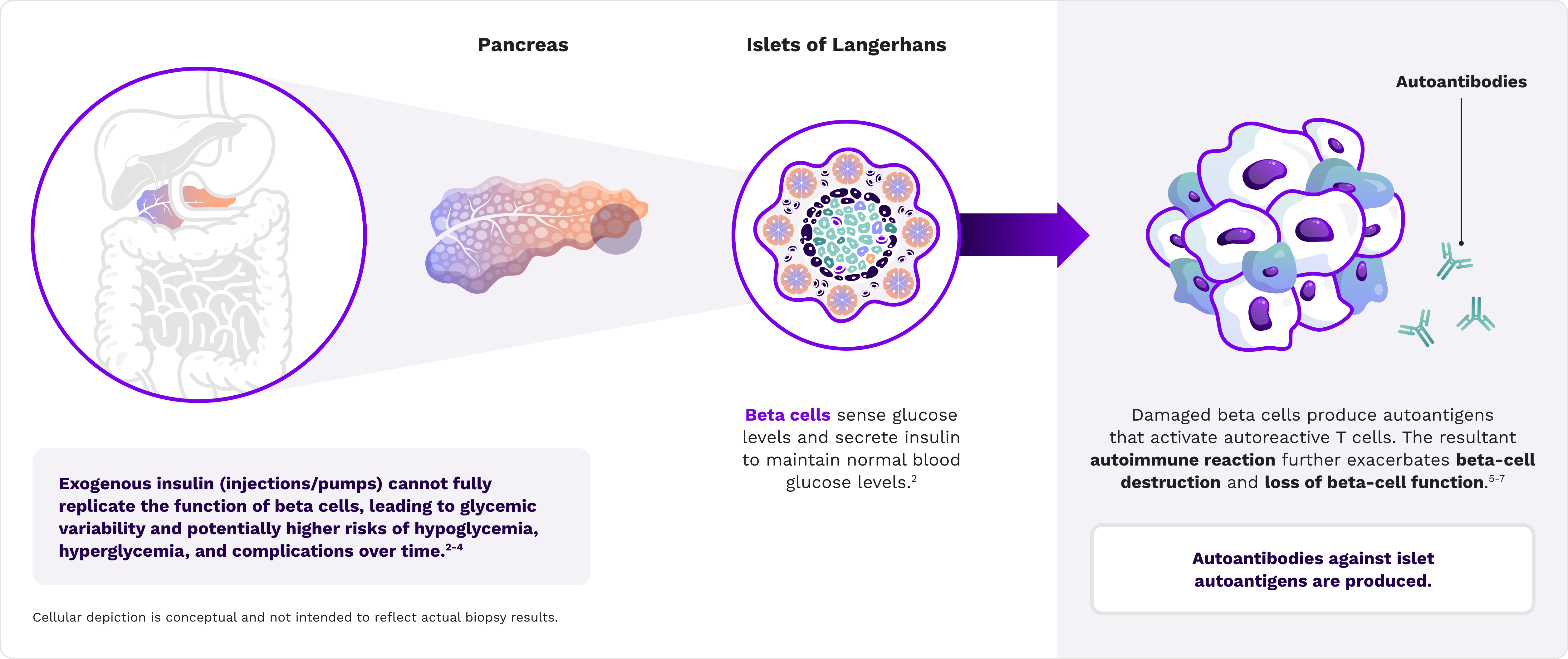 Illustration highlighting tight glycemic regulation requires endogenous insulin production by pancreatic beta cells. 